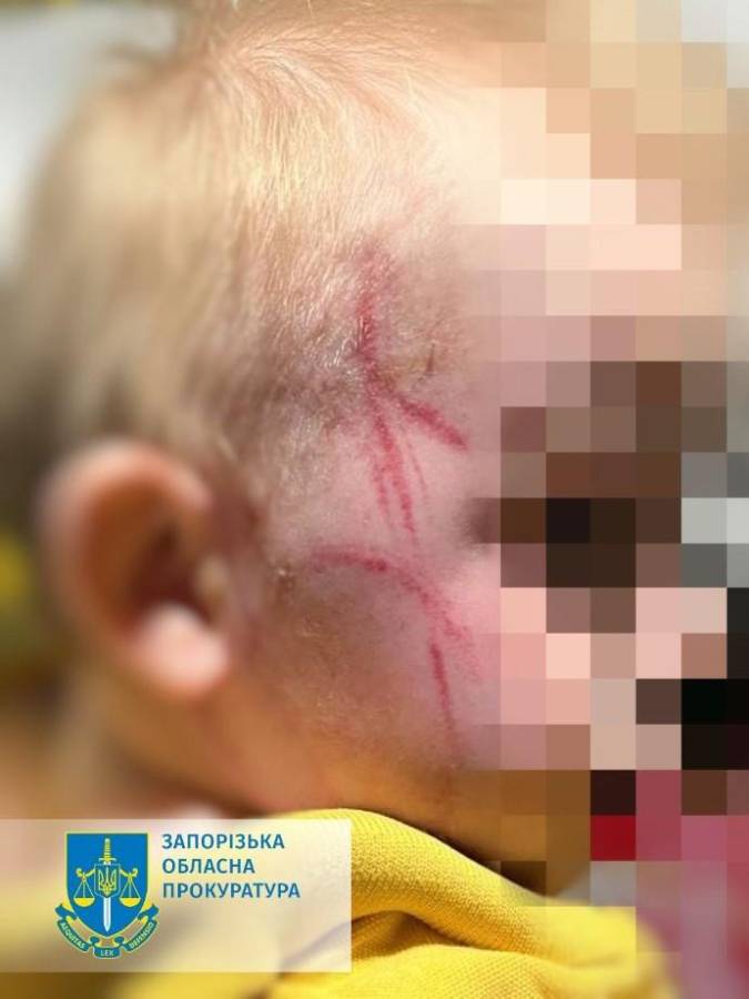 Жорстоко побила шнуром: у Запоріжжі судитимуть матір однорічного хлопчика (фото)