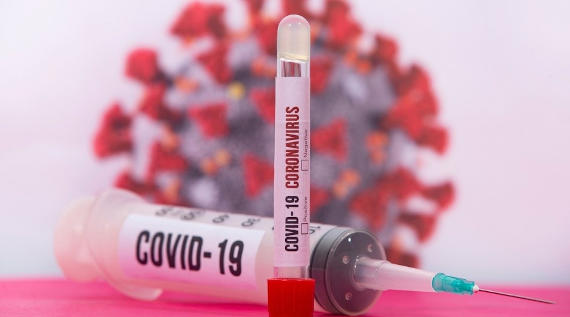 В Севастополе от коронавируса умер один человек и 58 новых случаев за сутки