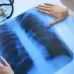 У селах Рожищенщини працюватиме пересувний флюорограф: графік обстежень