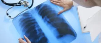 У селах Рожищенщини працюватиме пересувний флюорограф: графік обстежень