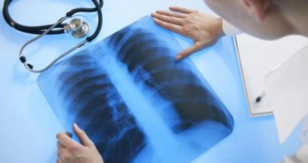 У селах Рожищенщини працюватиме пересувний флюорограф