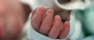 На Одещині від кору померла 9-місячна дитина