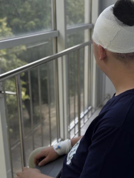 У Львові відомий нейрохірург Михайло Ловга видалив рідкісну пухлину з голови 14-річного хлопця з Миколаївщини1