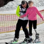 Дівчинка з Херсонщини стала першою дитиною в Україні, якій встановили протез після військової травми